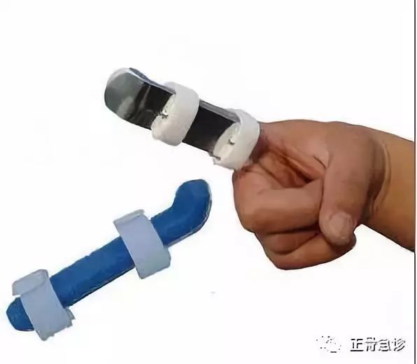 “锤状指”损伤——容易被忽视的手部畸形