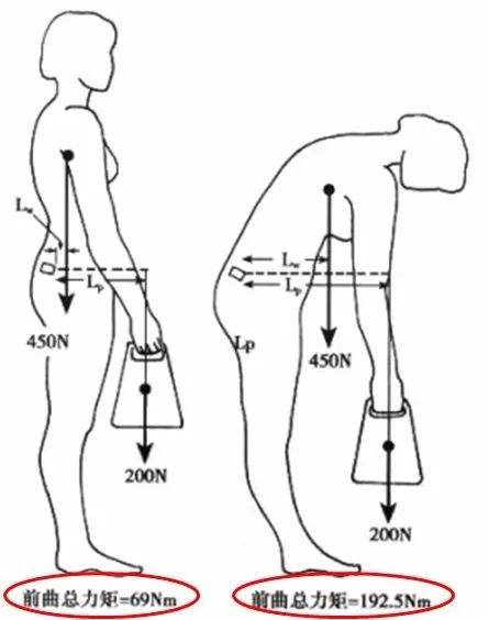 自测一下,看看你的腰突是哪个程度?
