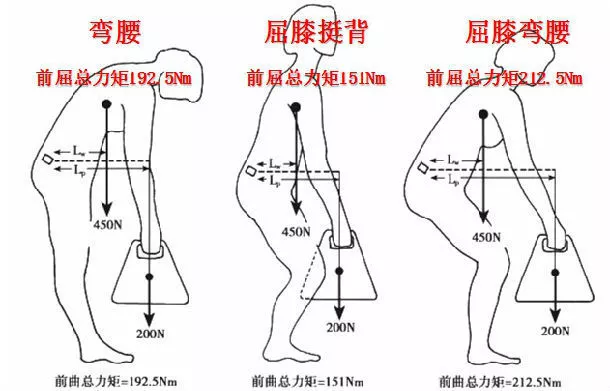 自测一下,看看你的腰突是哪个程度?