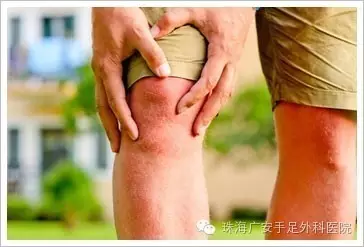 跷二郎腿有损膝关节健康, 请收回你的二郎腿!