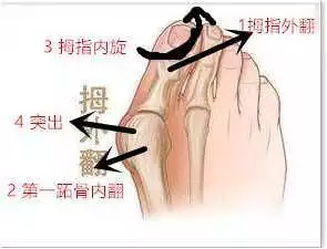 夏天到了!你还在为这种病困扰吗?