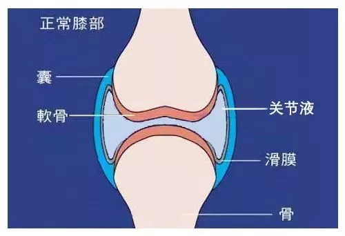 正常关节里有“水”吗?关节腔积液的症状?