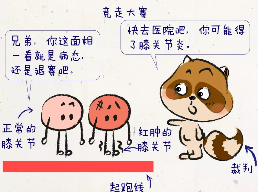 膝关节退变分“4阶” 自己检查一下是哪阶