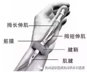你的手是不是已经变成了“手机手”?