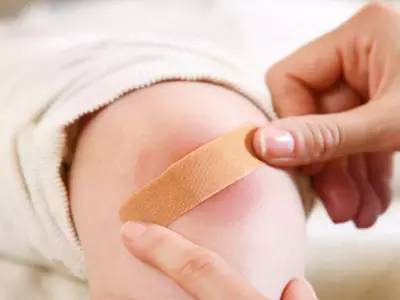 小伤口的急救误区 图片