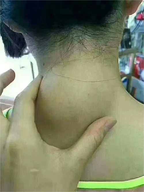 u=4114358183,3411633365&fm=253&fmt=auto&app=138&f=JPEG(1).png 图片