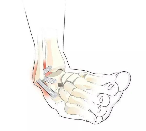 63d9f2d3572c11df38513b014d06dad4f703c232.jpeg 图片