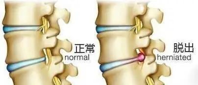 7f235fb8733841868e8a90c03c936a47.jpeg 图片