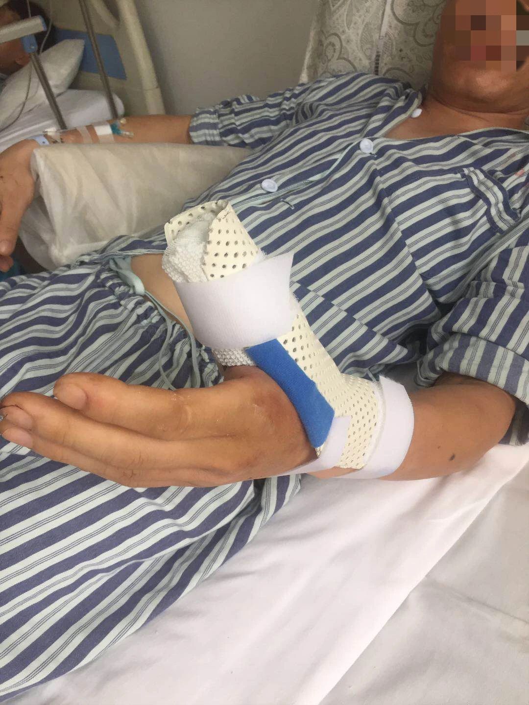 手指断掉着急寻找医院做手术 交警帮助连跑三家医院成功接回