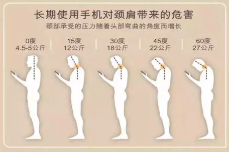 颈椎不好，脖子酸痛有必要拍片检查吗？